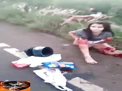 Don't worry, woman has a severed leg