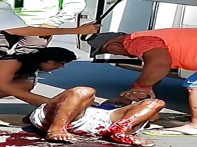 Motorcyclist's leg smashed by bus.