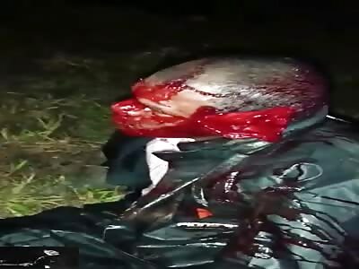 STAYING ALIVE AFTER BEING SCALPED DOESN'T LOOK FUN