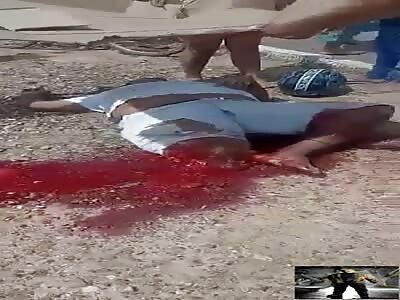 Poor victim has his leg severed in an accident