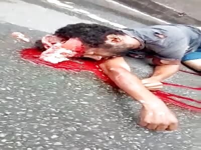 Cracked skull in accident