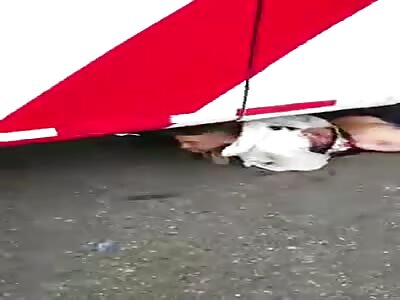 Victim of a serious accident has his leg cut off