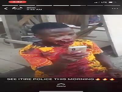 Boy gets shot in the mouth by police