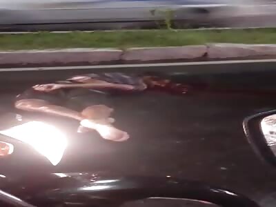 Broken head in accident