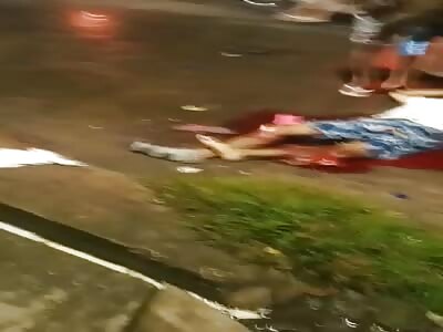 Victim of a serious accident without the leg