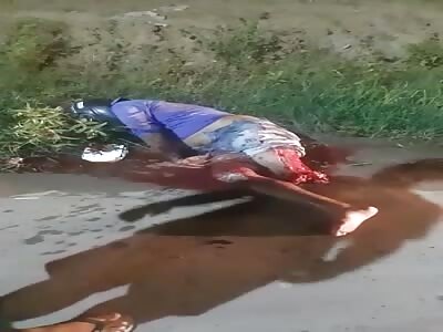 Biker passed out with his leg severed