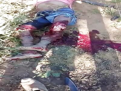 Damn, biker got his leg ripped off when he hit a bumper