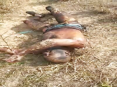 Worker burned in accident