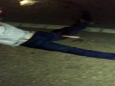 victim has leg torn off on highway