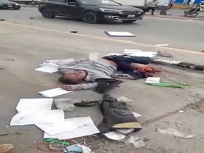 Man has leg severed in accident 