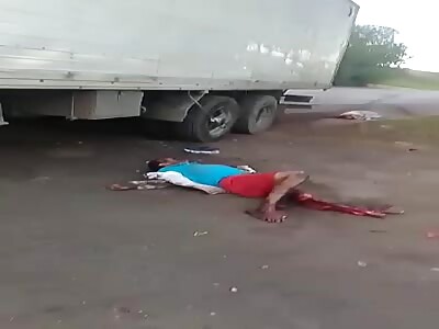 Drunk couple suffered serious accident