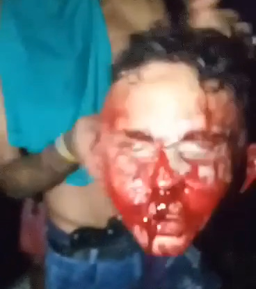 Somehow Brazil Is Getting Worse (Disturbingly Brutal)