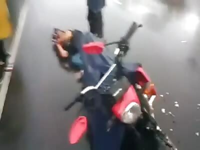 Broken leg in accident