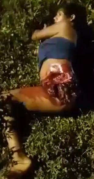 Woman has her leg severed in accident