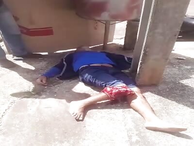 Victim of terrible leg injury