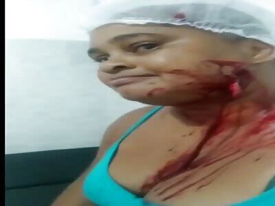 Cook cut with knife in the face.