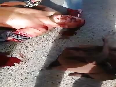 Man has injured arm in accident