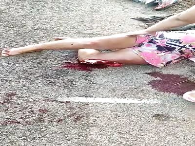 Victim with open fracture