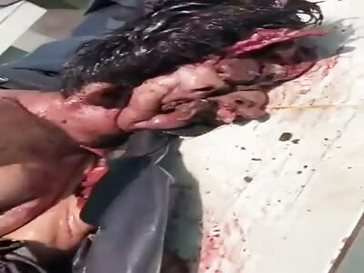 Ground man on a stretcher