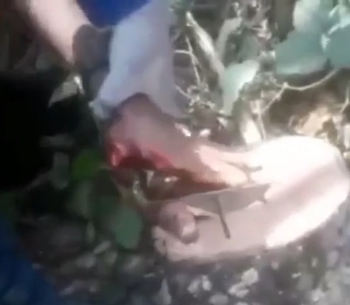 Kidnapped Businessman Gets Finger Amputated For Ransom (Fixed Video)