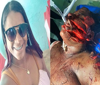 DAMN! Woman Hacked Up Like a Piece of Raw Pork