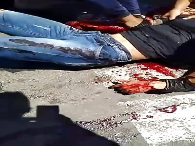 Terrible, biker had his hand cut off with a machete