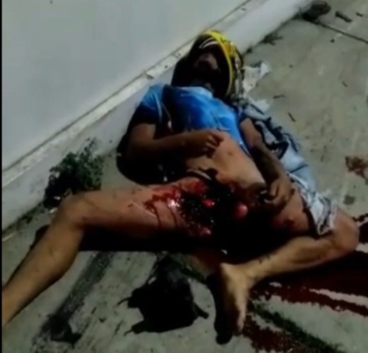 couple crashes into terrible accident in campina grande, brazil