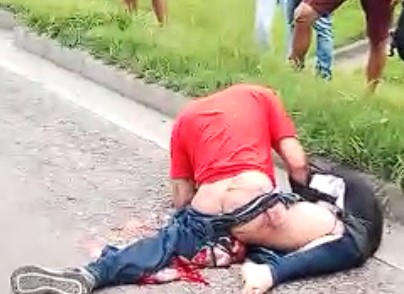 HORRIBLE AGONY, man with his legs crushed