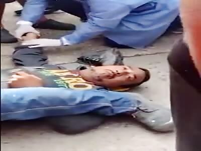 Extreme pain, man totally crushed by a bus