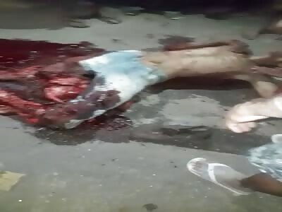 Terrible accident., sir got your legs crushed