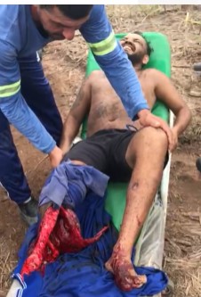 Reason to Stay the Fuck Away From Heavy Machinery (Aftermath)