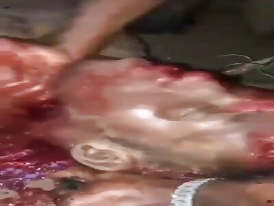 Thug Tries to Hack Rival's Head With Dull Knife