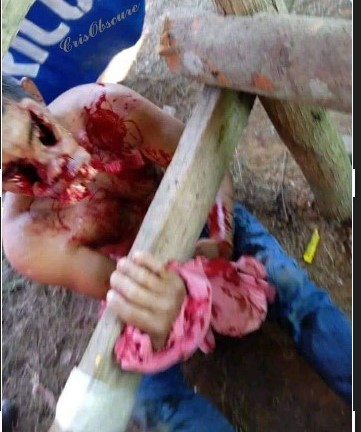 Moron Loses Both Eyes At Bull Show In Colombia