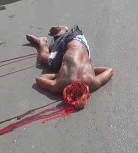 Man has his brain ripped out