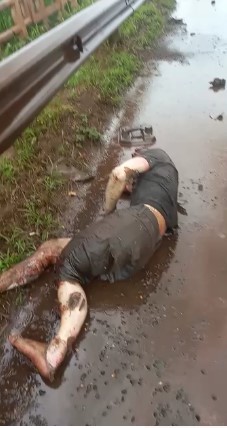 Victim with burnt body and broken leg