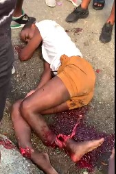 Man has his legs destroyed in an accident and street