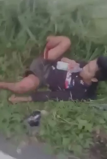 vietnamese severed legte