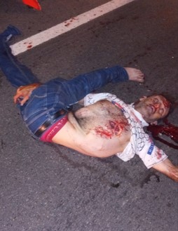 Man separated in accident