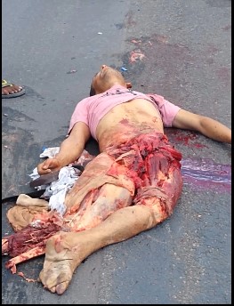 Man turned into a human pancake