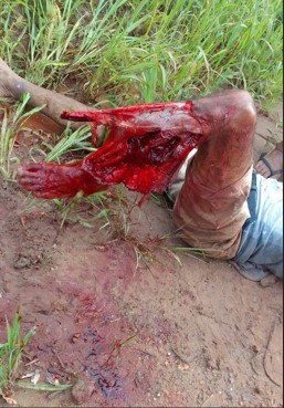 old man with a severed leg