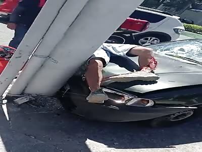 young  man with a severed leg