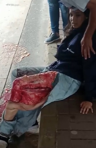 I Don't Know Wtf Caused This, But It Isn't Pretty