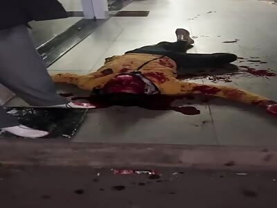 Horrible, Man Vomiting His Guts When Shot