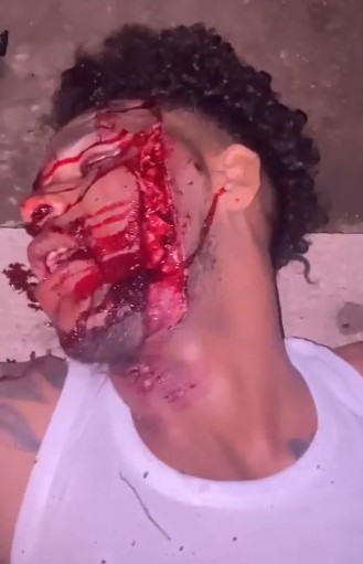 biker had a crack and south and his face