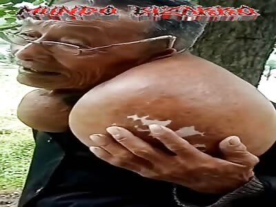  most bizarre diseases (compilation)