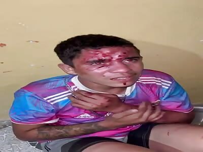 thief brutally beaten with thick chain