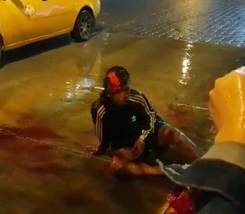 Dude got Scalped in the Rain