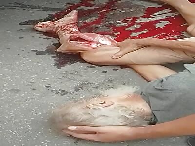 poor old man got his leg crushed