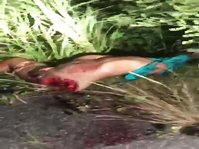 the victim was dismembered motorcycle collision