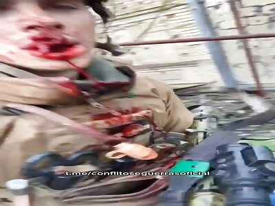 wounded soldier with gunshot to the mouth